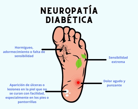 Neuropatía diabética pies