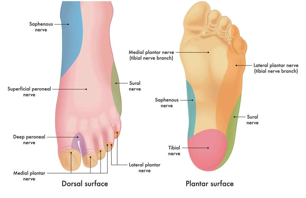 Neuropatía periferica pies